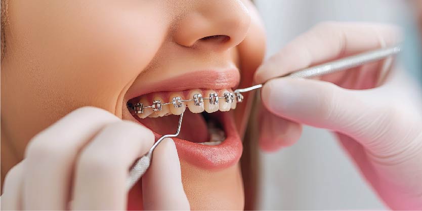Orthodontic Treatment-01
