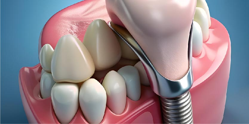 Restorative Treatment-01